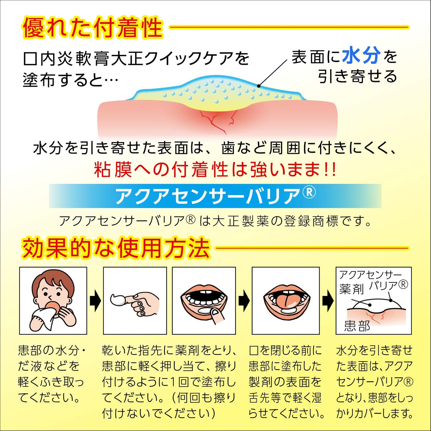 大正口內炎軟膏 5g | 第2類醫藥品 | 緩解口腔炎症、口瘡、舌炎 | 日本製