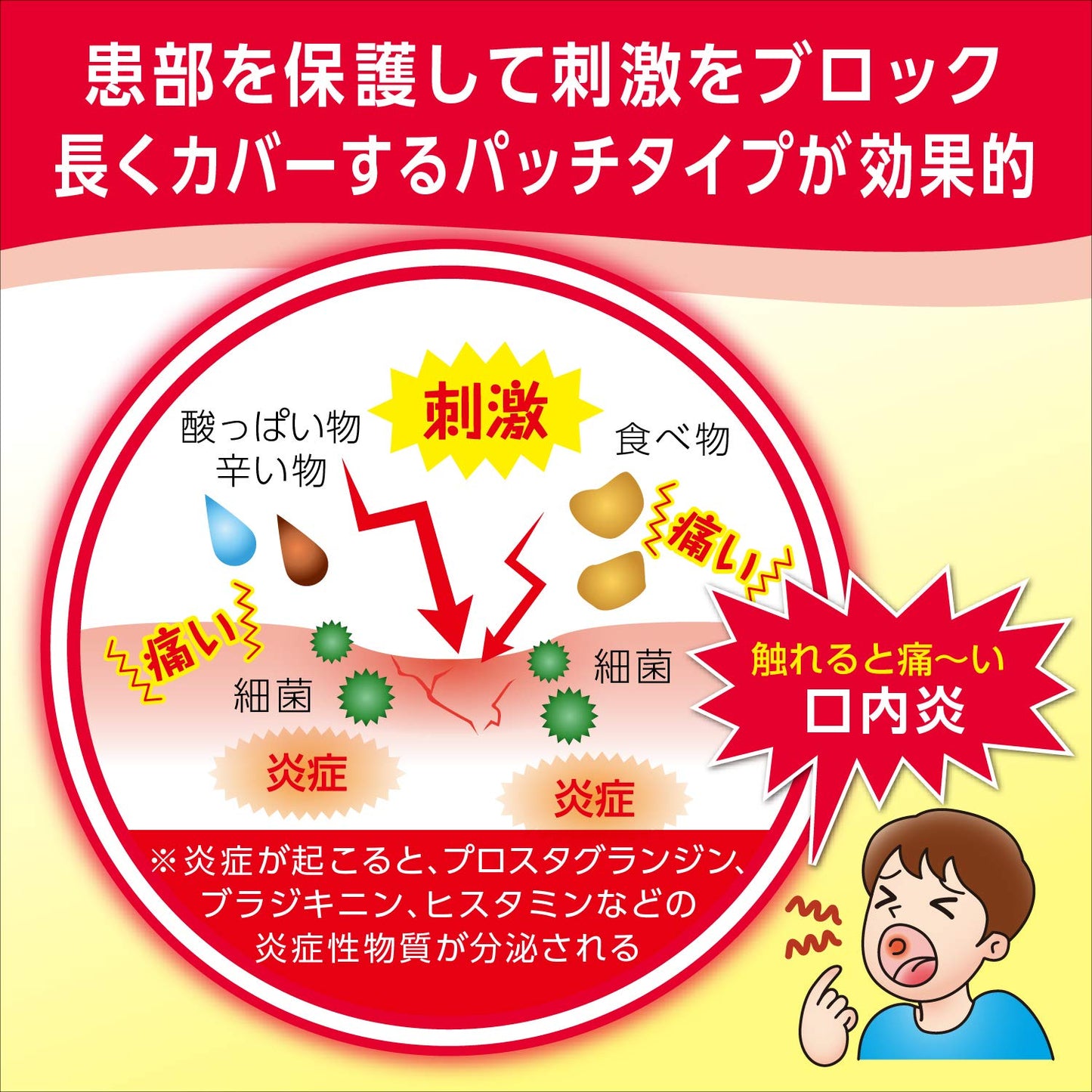 大正口內炎貼片 10枚 | 第2類醫藥品 | 緩解口腔炎症、口瘡、舌炎 | 口內保護膜 | 日本製